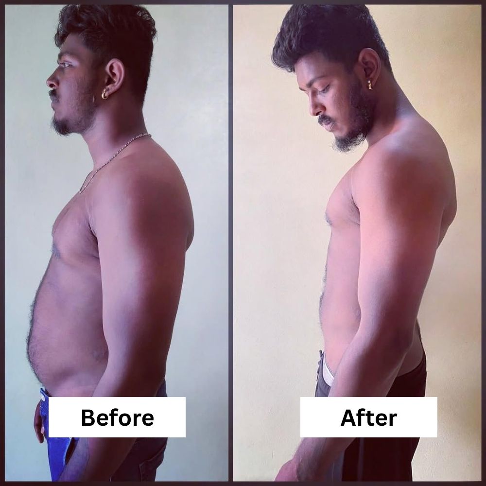 before-after (5)