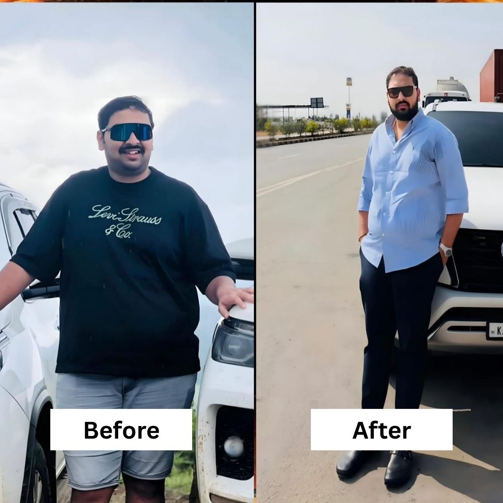 before-after (6)