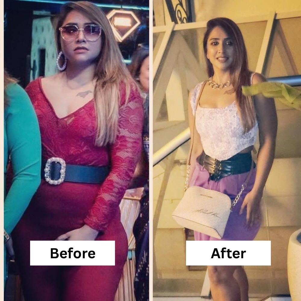 before-after (8)